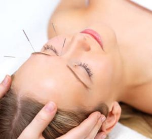 Health Med Training Solutions Featured course Facial Cosmetic Acupuncture